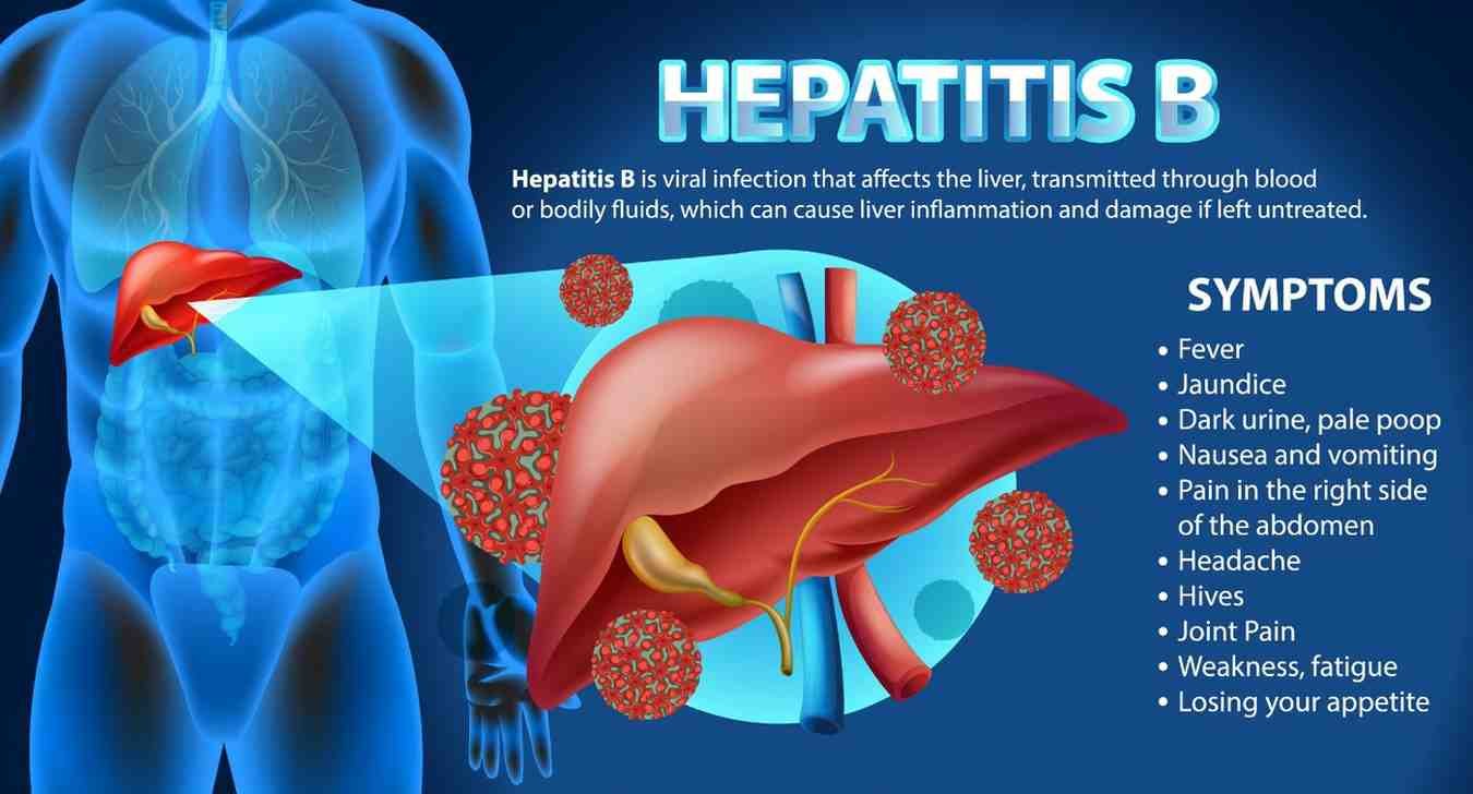 Hepatitis B