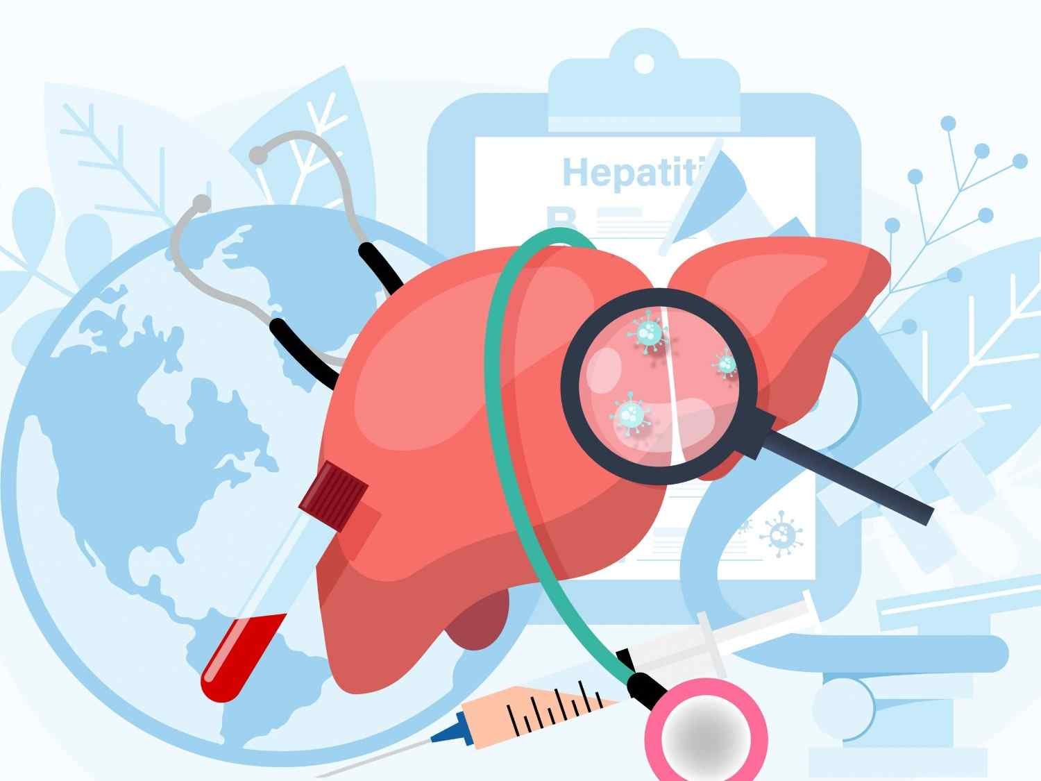 Hepatitis B